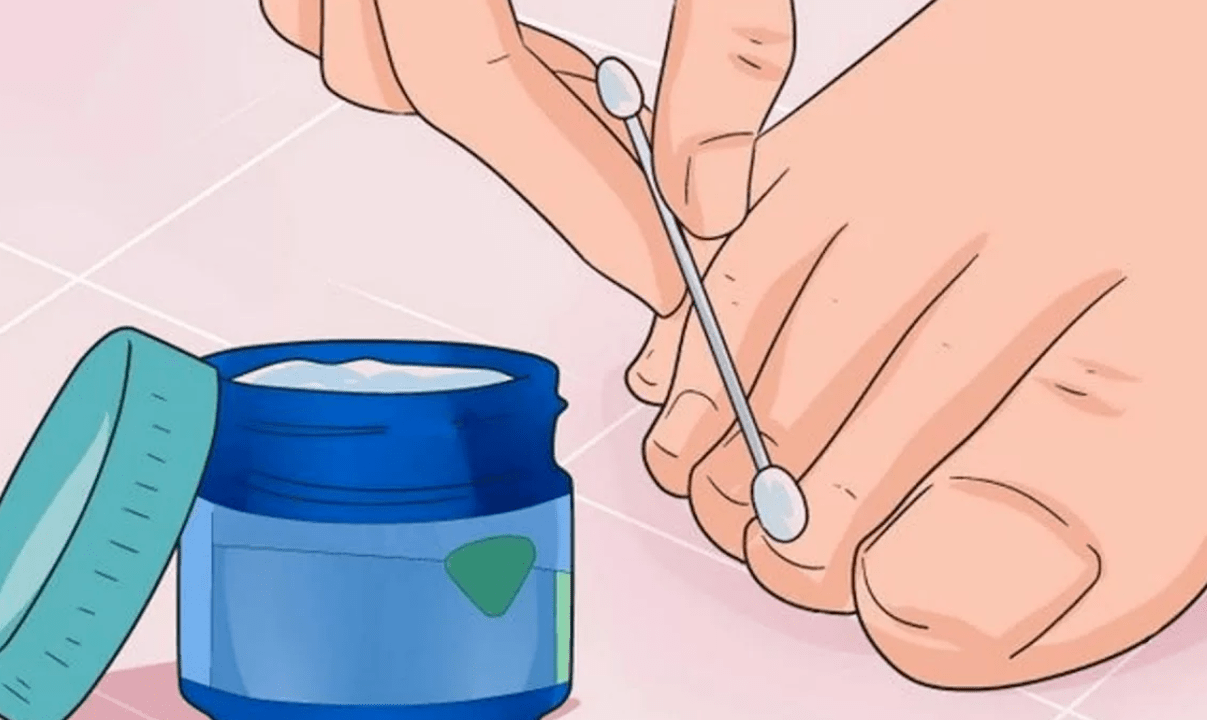 treatment