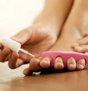 Application of therapeutic varnishes